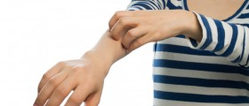 Medicinal And Natural Ways to Treat Contact Dermatitis